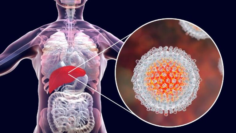 Hepatitis-C